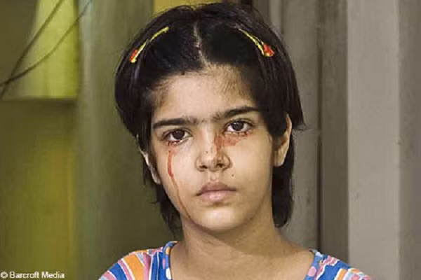 Loat benh hiem gap thach thuc y hoc-Hinh-3