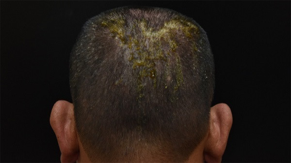 Tràn lan thuốc nhuộm tóc không rõ nguồn gốc - Hình 2 Tran lan thuoc nhuom toc khong ro nguon goc-Hinh-2