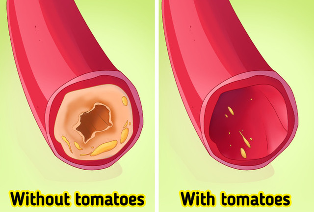 Cơ thể thay đổi kỳ diệu khi ăn cà chua mỗi ngày - Hình 2 Co the thay doi ky dieu khi an ca chua moi ngay-Hinh-2