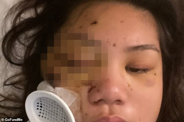 Phụ nữ gốc Á là nạn nhân các vụ tấn công ở Mỹ - Hình 7 Phu nu goc A la nan nhan cac vu tan cong o My-Hinh-7