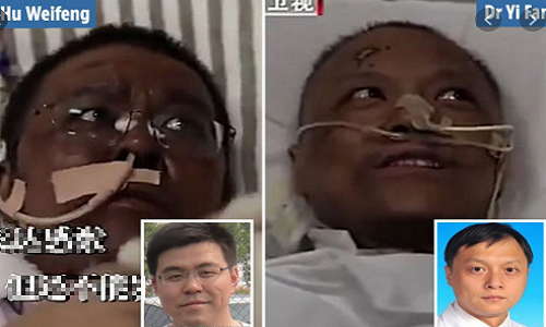 Vì sao màu da của bác sĩ nhiễm COVID-19 ở Vũ Hán thay đổi bất thường? Vi sao mau da cua bac si nhiem COVID-19 o Vu Han thay doi bat thuong?