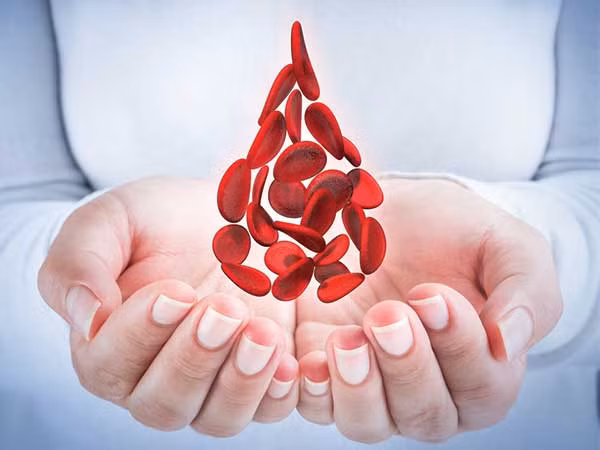 Dau hieu canh bao som ung thu mau nhieu nguoi bo qua-Hinh-3