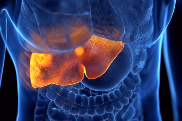 Uong thuong xuyen nuoc co duong lam tang nguy co mac ung thu gan