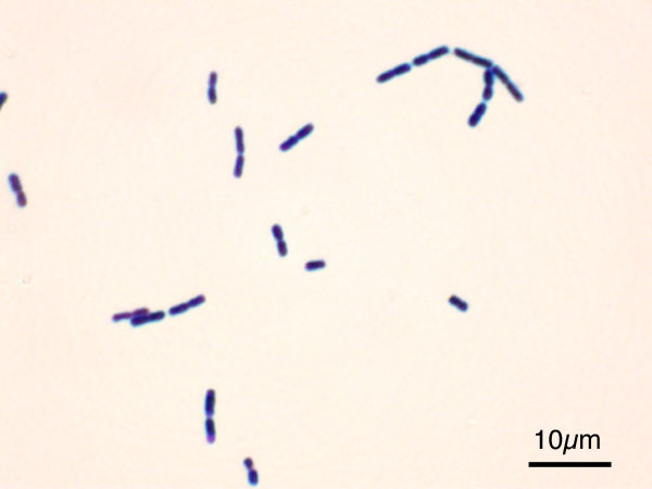 Vụ cá chép muối ủ chua: Loạt món lạ gây ngộ độc thực phẩm - Hình 6 Vu ca chep muoi u chua: Loat mon la gay ngo doc thuc pham-Hinh-6