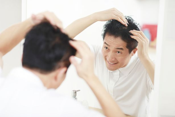 Dấu hiệu nhận biết bệnh tiểu đường loại 2 qua mái tóc Dau hieu nhan biet benh tieu duong loai 2 qua mai toc
