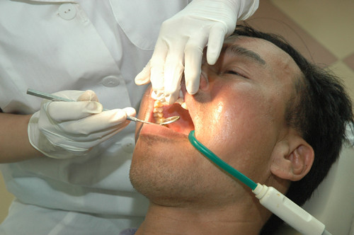 Biểu hiện của u do răng sừng hóa Bieu hien cua u do rang sung hoa