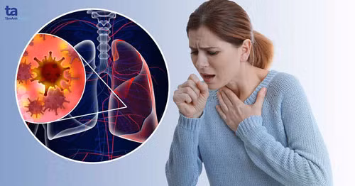 Ngoài khói thuốc lá, còn loạt tác nhân hàng ngày cũng gây ung thư phổi - Hình 9 Ngoai khoi thuoc la, con loat tac nhan hang ngay cung gay ung thu phoi-Hinh-9