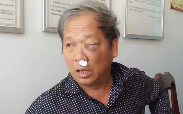 Đọc gì hôm nay 28/1: Đứt lìa tay khi hỗn chiến tại quán cà phê - Hình 2 Doc gi hom nay 28/1: Dut lia tay khi hon chien tai quan ca phe-Hinh-2
