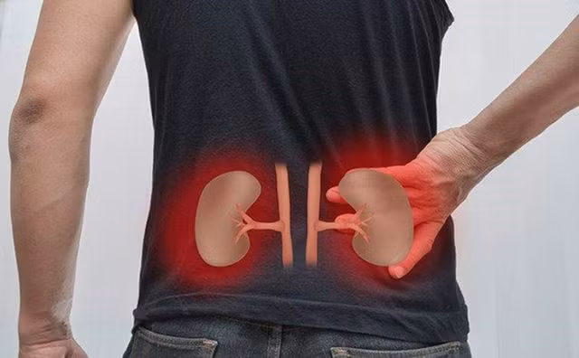 Lưu ý 3 vị trí đau cảnh báo bệnh thận - Hình 8 Luu y 3 vi tri dau canh bao benh than-Hinh-8