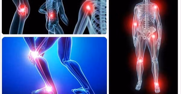 Quả mận cực có lợi cho sức khỏe mà ít ai biết - Hình 7 Qua man cuc co loi cho suc khoe ma it ai biet-Hinh-7