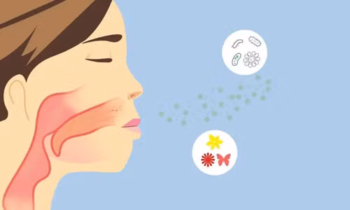 Nhận biết viêm nắp thanh quản cấp cực nguy kịch trong thời gian ngắn - Hình 2 Nhan biet viem nap thanh quan cap cuc nguy kich trong thoi gian ngan-Hinh-2