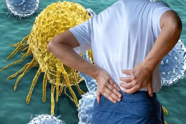 Một số triệu chứng cảnh báo ung thư thường bị bỏ qua Mot so trieu chung canh bao ung thu thuong bi bo qua