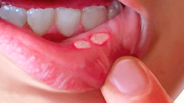 Ăn gừng cả vỏ để nhận tối đa lợi ích? - Hình 6 An gung ca vo de nhan toi da loi ich?-Hinh-6