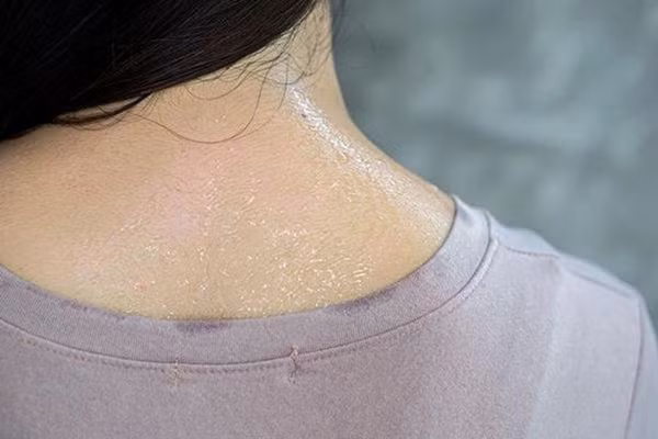 Đổ mồ hôi những vị trí này cảnh giác bệnh tật trong người - Hình 9 Do mo hoi nhung vi tri nay canh giac benh tat trong nguoi-Hinh-9