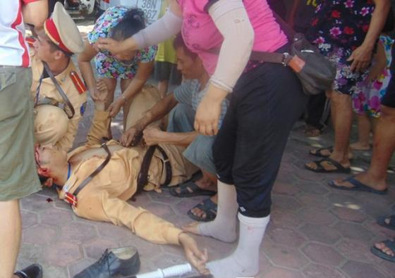 Dùng kéo đâm trung uý công an trọng thương khi bị chặn xe Dung keo dam trung uy cong an trong thuong khi bi chan xe