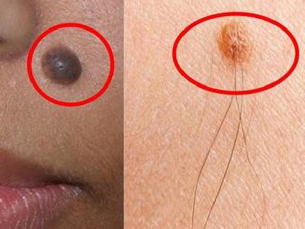 Chị em hãy tự hào vì lông càng mọc nhiều ở 3 vị trí này thì càng phát tài - Hình 2 Chi em hay tu hao vi long cang moc nhieu o 3 vi tri nay thi cang phat tai-Hinh-2