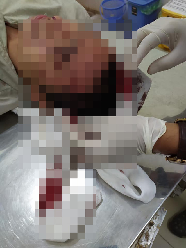 Khởi tố nhóm thanh niên truy sát kiểm lâm viên, cướp xe máy Khoi to nhom thanh nien truy sat kiem lam vien, cuop xe may