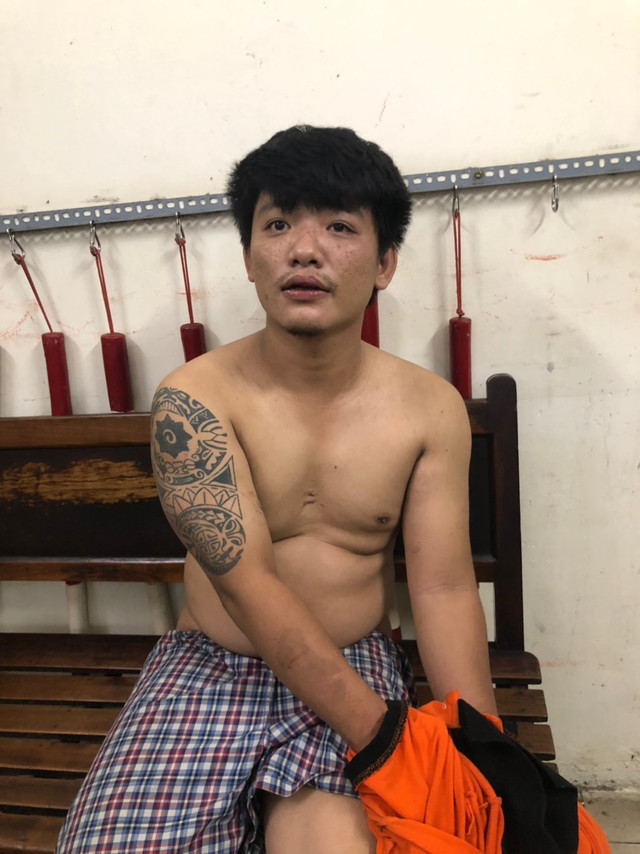 Trung uý Công an bị gãy tay khi khống chế kẻ ngáo đá Trung uy Cong an bi gay tay khi khong che ke ngao da