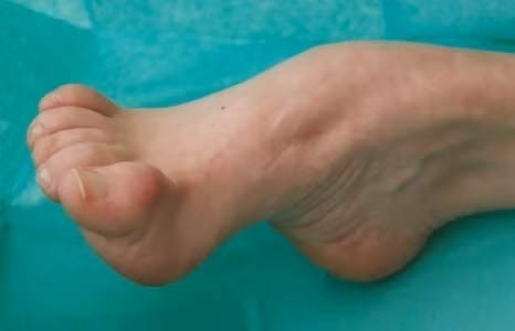 Benh di truyen khong the chua tri cu deo bam gia toc Samsung qua bao doi-Hinh-5