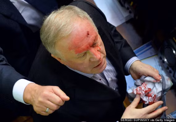 "Ông nghị" Vladimir Malyshev với gương mặt be bét máu sau trận ẩu đả.