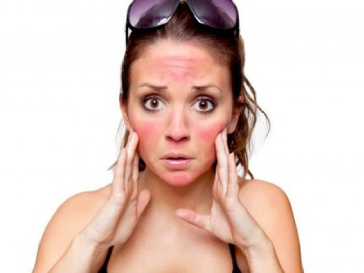 Vì vậy, để tránh tình trạng bị rát và bỏng da, khi đi ngoài đường, bạn nên có biện pháp tránh nắng phù hợp. Ảnh:Internet