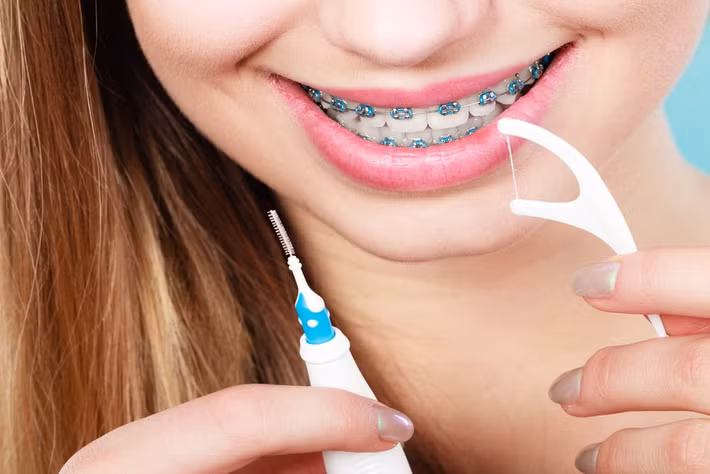 Với phần răng còn lại, bạn hãy làm tương tự. Khi đã sử dụng xong, bạn bỏ sợi chỉ đó và tuyệt đối không dùng lại. Ảnh: charlestonorthodonticspecialists.