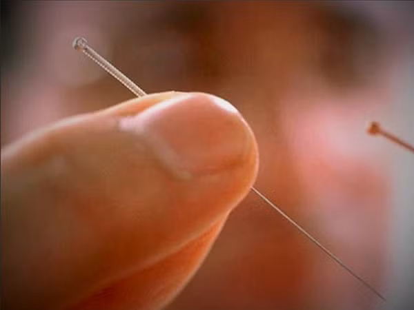 Thời điểm đó, máy móc còn thô sơ nên thạch tín thường lẫn với sunfua hoặc lưu huỳnh. Khi tiếp xúc với bạc, chúng phản ứng tạo thành lớp bạc sunfua màu đen trên trang sức. Vậy nhưng, công nghệ tinh chế hiện nay vô cùng hiện đại, trang sức bạc hoàn toàn không thể phát hiện asen có độ tinh khiết cao. Vì vậy, đeo trang sức bạc không thể giúp phát hiện độc tố trong cơ thể.