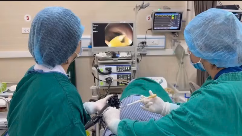 Phát hiện và gắp sán dây bò dài 1,2 mét qua nội soi