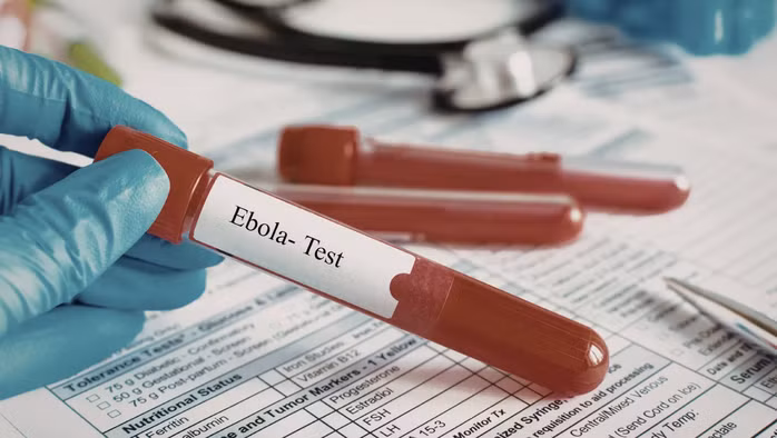 TP HCM siết giám sát cửa khẩu để ngăn nguy cơ dịch xâm nhập dịch dịch Ebola