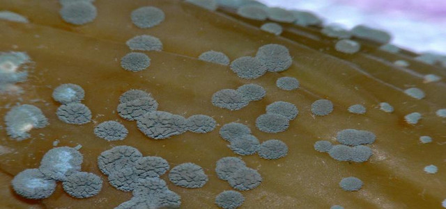 Cách xử lý nấm mốc khắp nhà để không hít phải độc - Hình 6 Cach xu ly nam moc khap nha de khong hit phai doc-Hinh-6