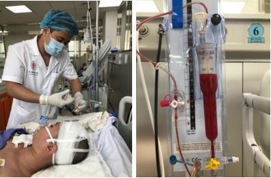 Kỳ tích cứu sống bệnh nhân 18 tuổi đột quỵ não nặng, hôn mê sâu Ky tich cuu song benh nhan 18 tuoi dot quy nao nang, hon me sau