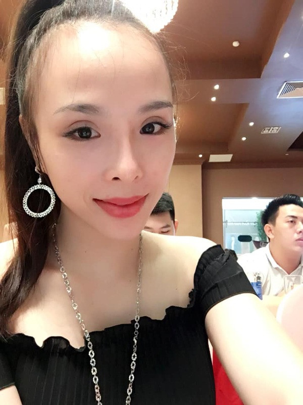 Cô bạn sở hữu trán dô có nickname T.D chia sẻ: "Cái trán của mình như cái đầu... Thực sự quá chán. Đầu thì có thể không gội chứ mái thì mình không bỏ sót ngày nào. Nhỏ đến giờ, mình chỉ ước trán được bình thường như bao người khác để có thể làm đủ kiểu tóc mình thích".