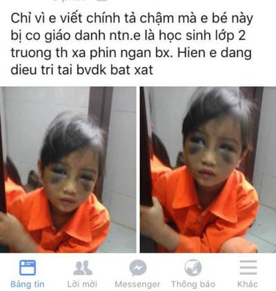 Một số em học sinh cùng lớp kể, trong giờ tập viết, T. viết bài chậm đã khiến cô giáo bực tức, nổi nóng và tát cháu T. nhiều cái vào mặt. Tại buổi họp Hội đồng kỷ luật, cô giáo Trà cho biết, mình đánh học sinh T. vào đầu, thái dương,... Vật dụng cô giáo dùng để đánh là thước kẻ, gậy tre và điện thoại.