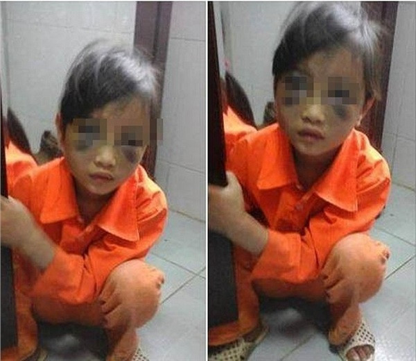 Tước đó, tháng 3/2016, cháu P.C.T. - học sinh lớp 1, trường tiểu học xã Phìn Ngan (Bát Xát, Lào Cai) bị cô giáo Trần Thị Thu Trà bạo hành trường học khiến cháu bị tím mặt mũi trong giờ học do em này viết sai chính tả và viết chậm.