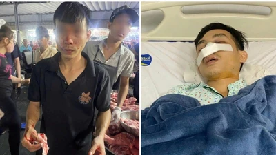 Điều tra vụ người dân bị hành hung tại chợ đầu mối Hóc Môn