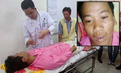 Anh Nam khóc khi nhớ về vụ tai nạn kinh hoàng khiến vợ chết, con trọng thương, bản thân anh mất đi một phần chân phải - Ảnh: Thanh Huyền.