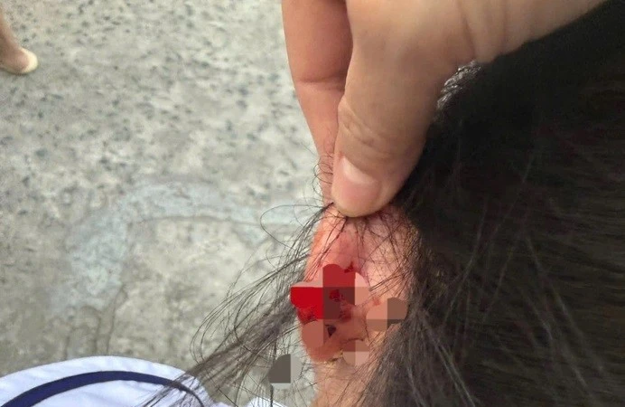 Phú Quốc: Làm rõ phản ánh giáo viên véo tai học sinh lớp 1