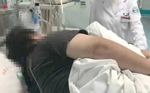Ngày ăn 1 bữa vẫn nặng 130kg khiến bác sĩ tá hỏa Ngay an 1 bua van nang 130kg khien bac si ta hoa