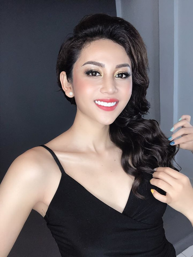 Trải qua nhiều ca phẫu thuật, 'Thánh lô tô' Lương Trung Kiên trở nên nữ tính hơn - Hình 9 Trai qua nhieu ca phau thuat, 'Thanh lo to' Luong Trung Kien tro nen nu tinh hon-Hinh-9