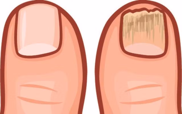 9 dau hieu cho thay co the ban dang chua nhieu doc to-Hinh-8