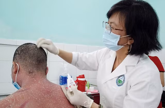 Tri vay nen bang Dong y: Loan san pham, cong dung-Hinh-6