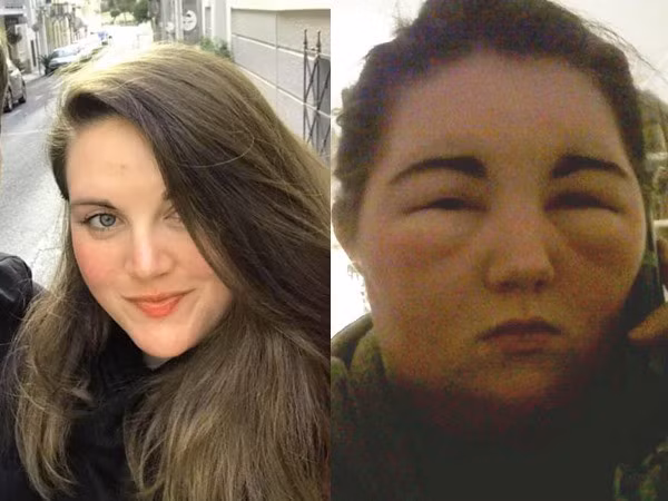 Lien tuc nhuom toc, co gai phai tra cai gia qua dat