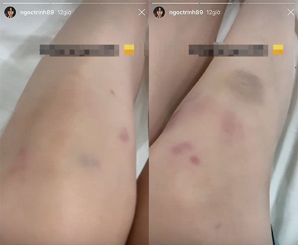 Sexy dance khiến Ngọc Trinh đam mê tập đến bầm tím có gì thích? Sexy dance khien Ngoc Trinh dam me tap den bam tim co gi thich?