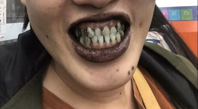 Loai kem den khien nguoi an vua khoc vua cuoi-Hinh-6