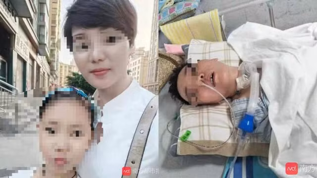 Xot xa nhung truong hop hon me sau vi dung “dao keo” lam dep