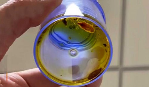 Chỉ vì món ăn ưa thích mà bị ký sinh trùng nhung nhúc trong mật - Hình 2 Chi vi mon an ua thich ma bi ky sinh trung nhung nhuc trong mat-Hinh-2