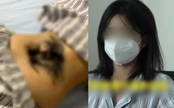 Cô gái mắc bệnh lạ... xoang lông Co gai mac benh la... xoang long