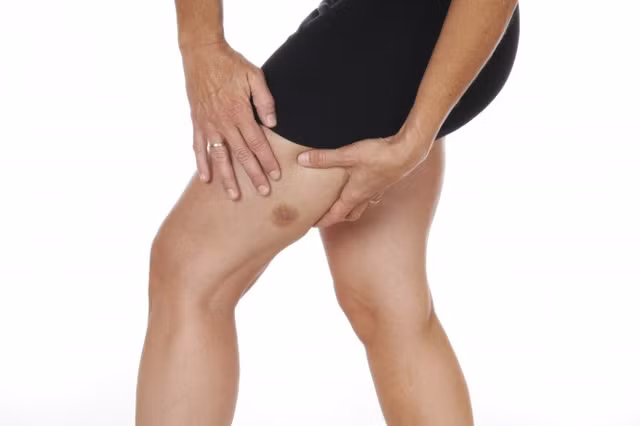 Vet bam quanh ron canh bao ung thu gan giai doan cuoi-Hinh-4