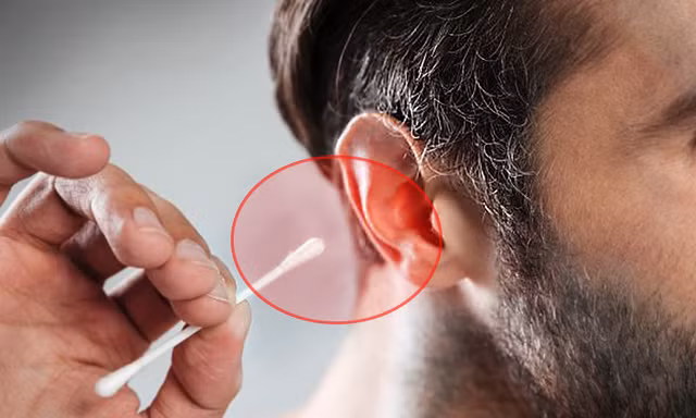 3 cong dung cuc hay cua ray tai-Hinh-5