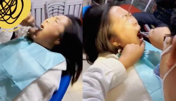 Bac si nha khoa khien ai cung het hon khi nho rang khon